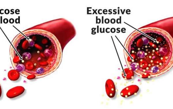 https://ipsnews.net/business/2021/05/14/glucofort-2021-blood-sugar-support-formula-side-effects-ingredients-price-and-re