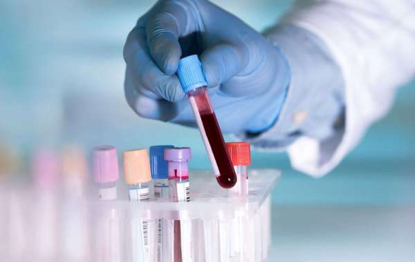 Blood Collection Sector: Growth Prospects and Competitive Landscape