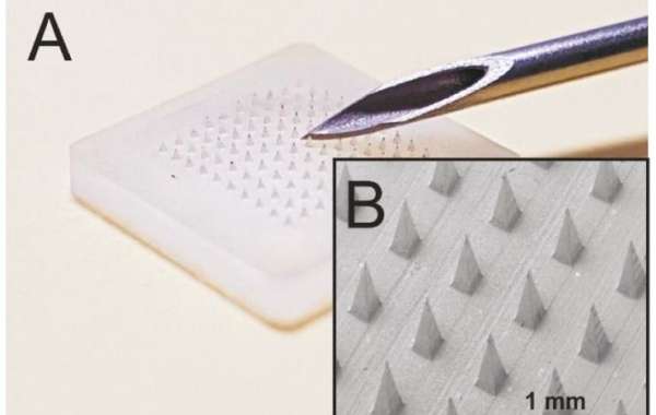 Microneedle Drug Delivery System Market Consumer Experience: Enhancing Patient Satisfaction